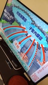 20220413NHKƥӻҵ2